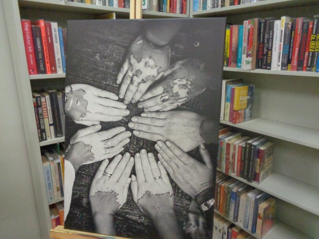 Piękno bielactwa 13