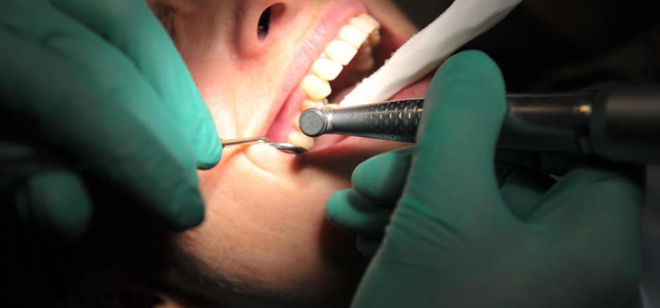 Trzeci komplet zębów zamiast tradycyjnych implantów - rozwiązanie polskich naukowców
