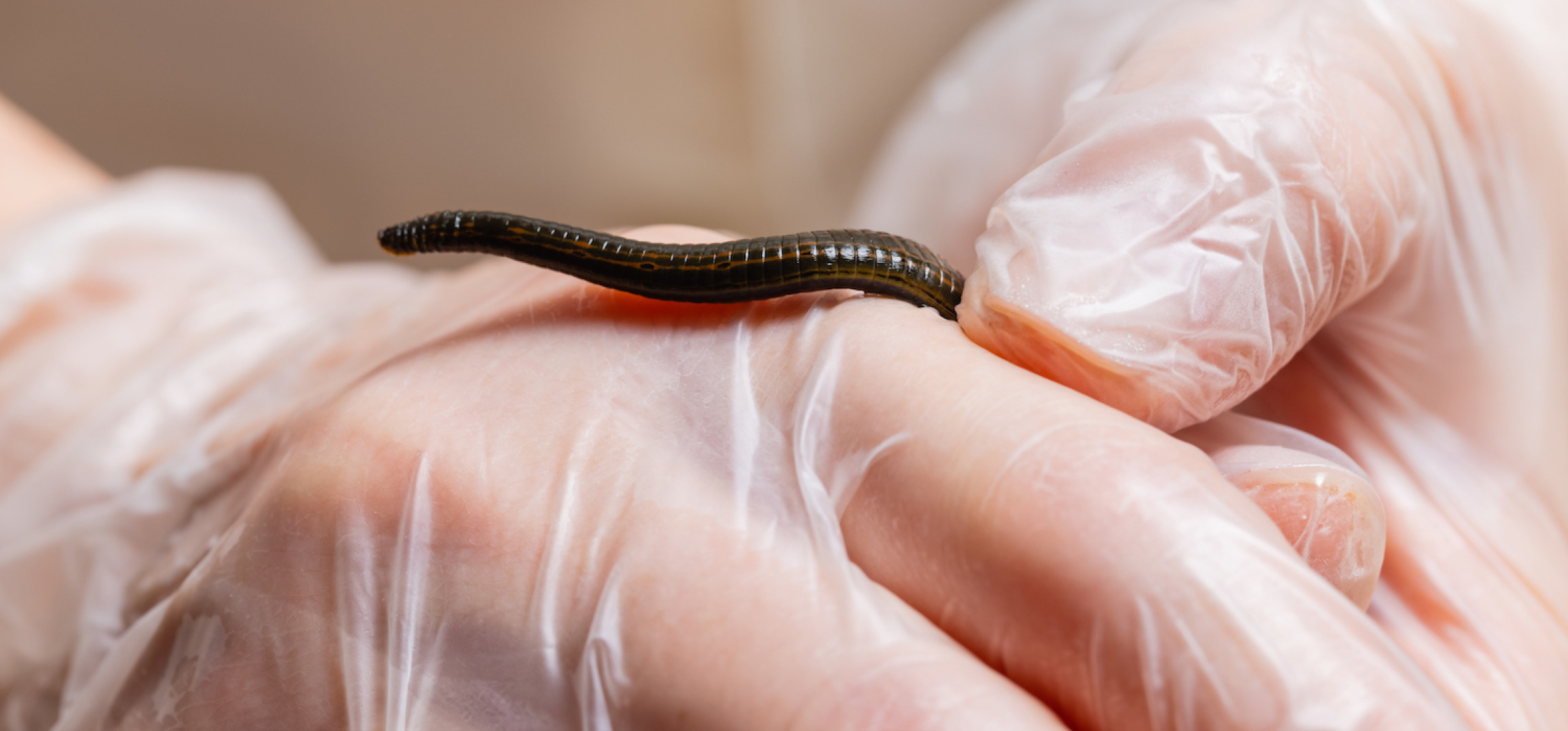 Jak hirudoterapia może pomóc Ci walczyć z chorobami reumatycznymi?