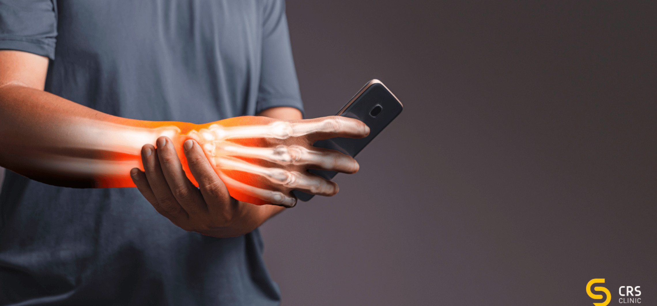 Zespół cieśni nadgarstka - objawy, leczenie