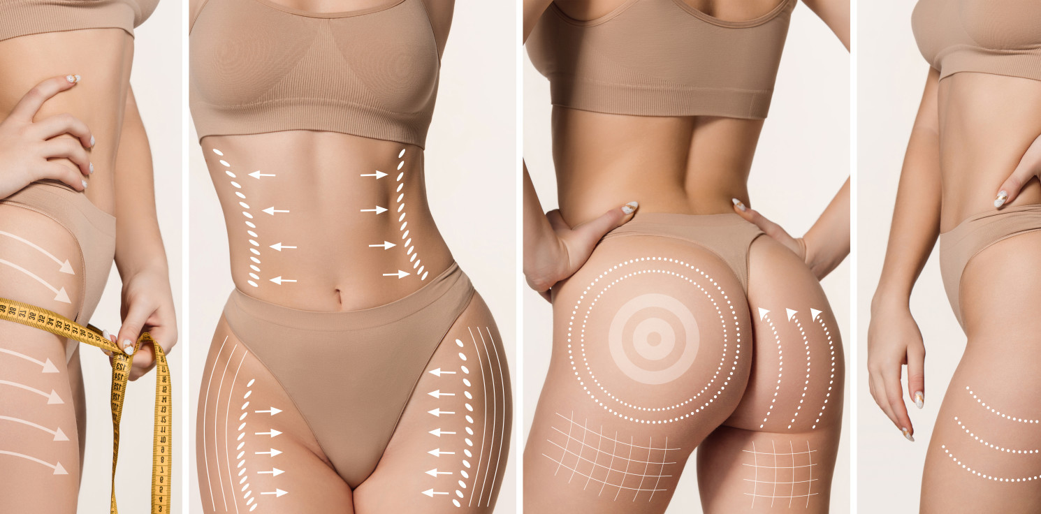 Region - Lipoliza iniekcyjna vs ultradźwięki – porównanie metod modelowania sylwetki